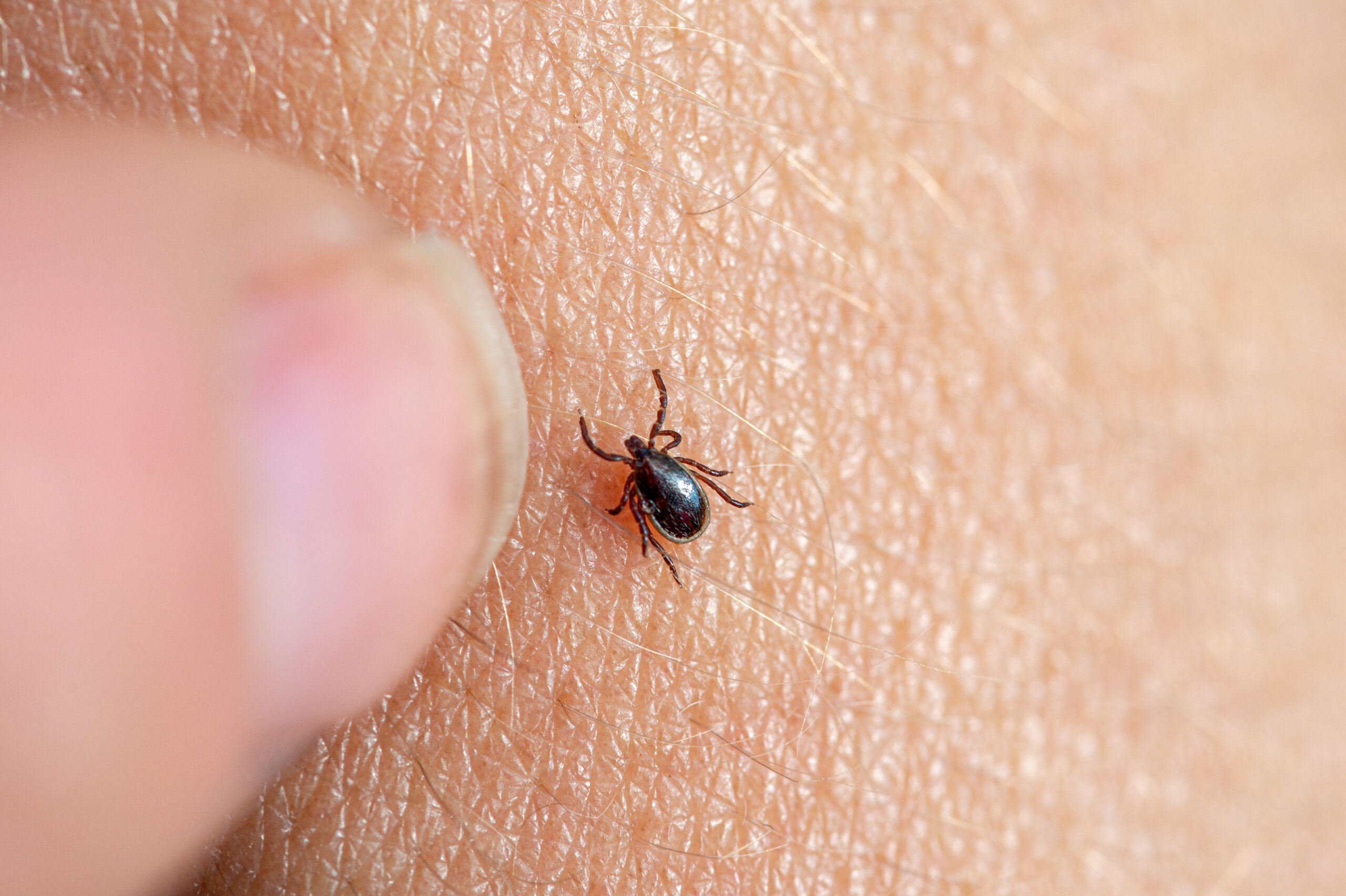 Tick Control in Hanover, MD: Yard Treatments That Work